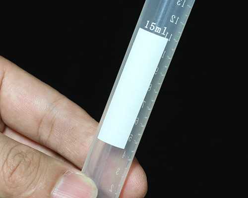 揭秘产检的性别判断指标与辅助生殖的奥秘