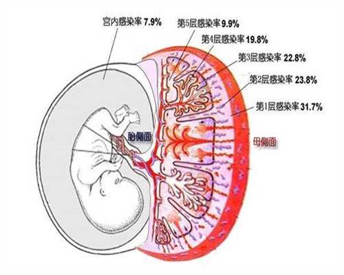 广州代孕哪里好_广州代孕对身体有影响吗_广州代