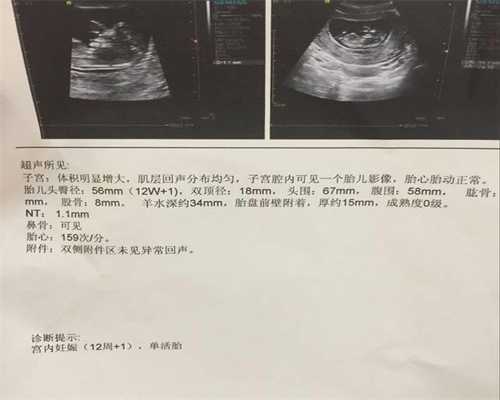 广州代孕妈妈是怎么代孕的_广州专业代怀孕包性