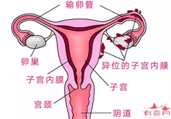 广州代孕辅助生殖中心在哪里_广