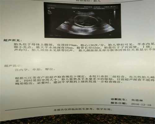 广州哪里有代孕_广州代生男孩医生咨询_广州代生双胞胎靠谱吗
