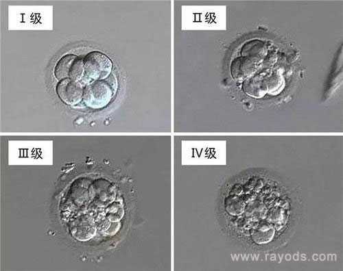 清远借卵生子像妈妈吗_试管胚胎等级分类，二级胚胎是不是优质胚胎？