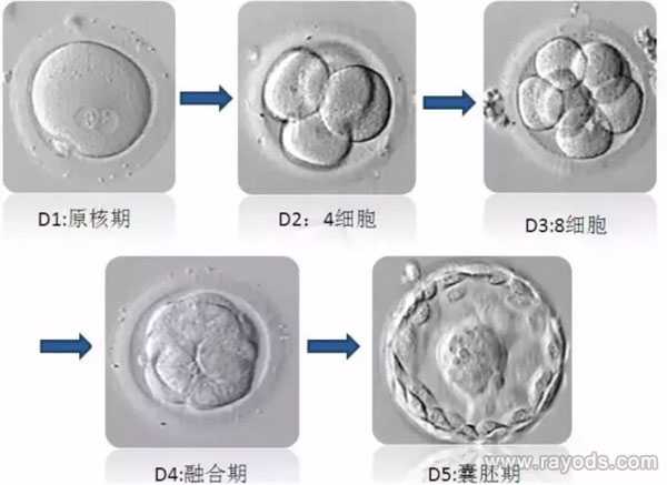 清远借卵生子像妈妈吗_试管胚胎等级分类，二级胚胎是不是优质胚胎？
