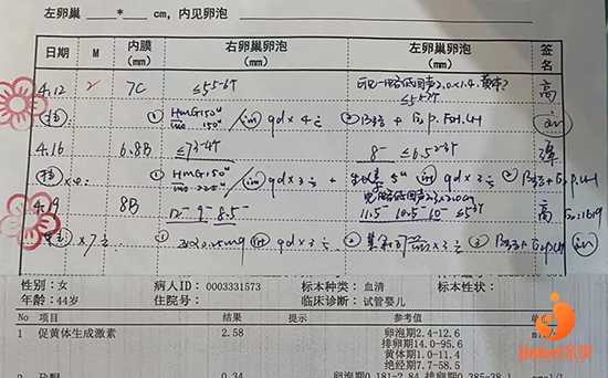 台州哪里可以借卵试管_我44岁做了3次试管婴儿，该记录总结一下了