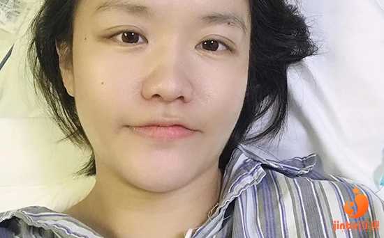 佛山48岁打卵巢干细胞_湖南湘雅医院是指中信湘雅还是中南大学湘雅医院，做试