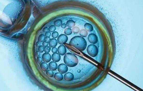 广州供卵试管机构微信 广州生殖科哪家医院厉害 ‘孕囊数值多少是男孩’